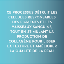 Charger l'image dans la galerie, Photorajeunissement 3-en-1