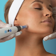 Charger l'image dans la galerie, Microneedling