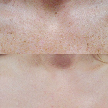 Charger l'image dans la galerie, Photorajeunissement