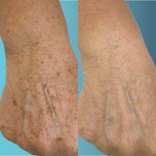 Charger l'image dans la galerie, Photorajeunissement