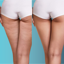 Charger l'image dans la galerie, Endermologie