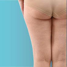 Charger l'image dans la galerie, Radiofréquence corporelle