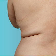 Charger l'image dans la galerie, Radiofréquence corporelle