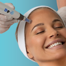 Charger l'image dans la galerie, Microneedling