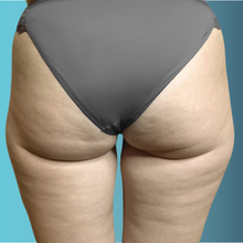 Charger l'image dans la galerie, Radiofréquence corporelle