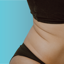 Charger l'image dans la galerie, Radiofréquence corporelle