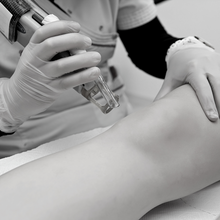 Charger l'image dans la galerie, Épilation définitive, Bas du corps