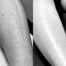 Charger l'image dans la galerie, Épilation définitive, Bas du corps