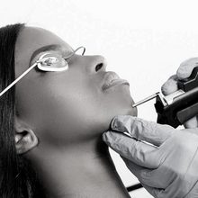 Charger l'image dans la galerie, Épilation définitive, Visage