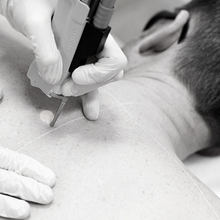 Charger l'image dans la galerie, Épilation définitive, Haut du corps